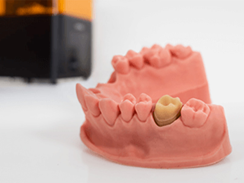 Stampa_3D-Campi di applicazione_006_Dentale.png